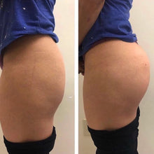 Charger l'image dans la galerie, Injection fesses hyacorp au cabinet 10 seringues