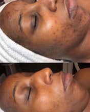 Charger l&#39;image dans la galerie, MELANINSKIN EXPERT Gamme réparatrice taches et acnés
